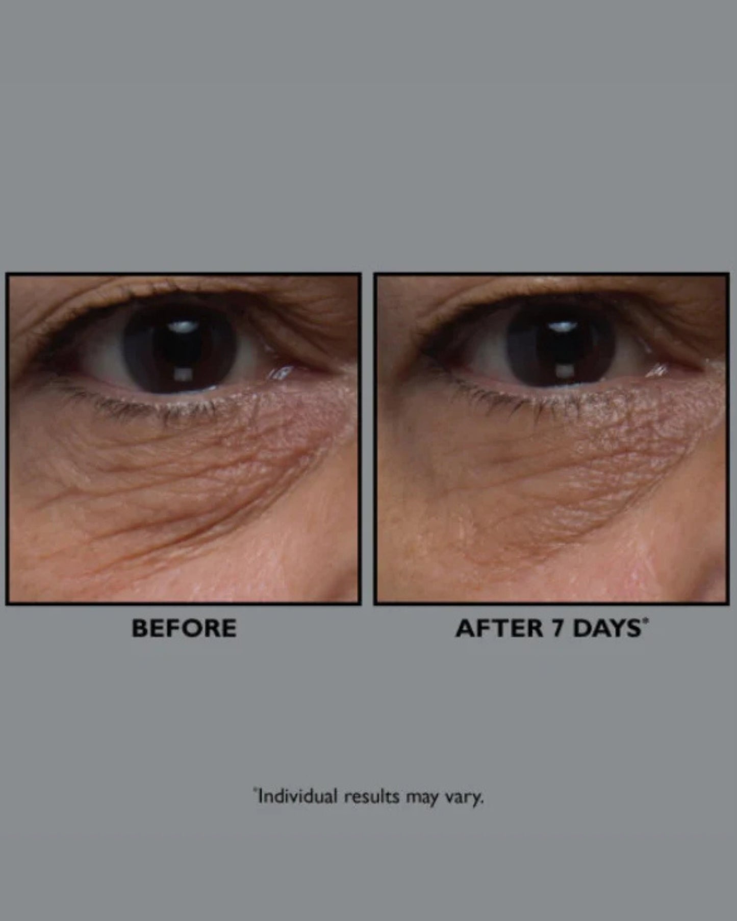 FIRMx Collagen Eye Cream