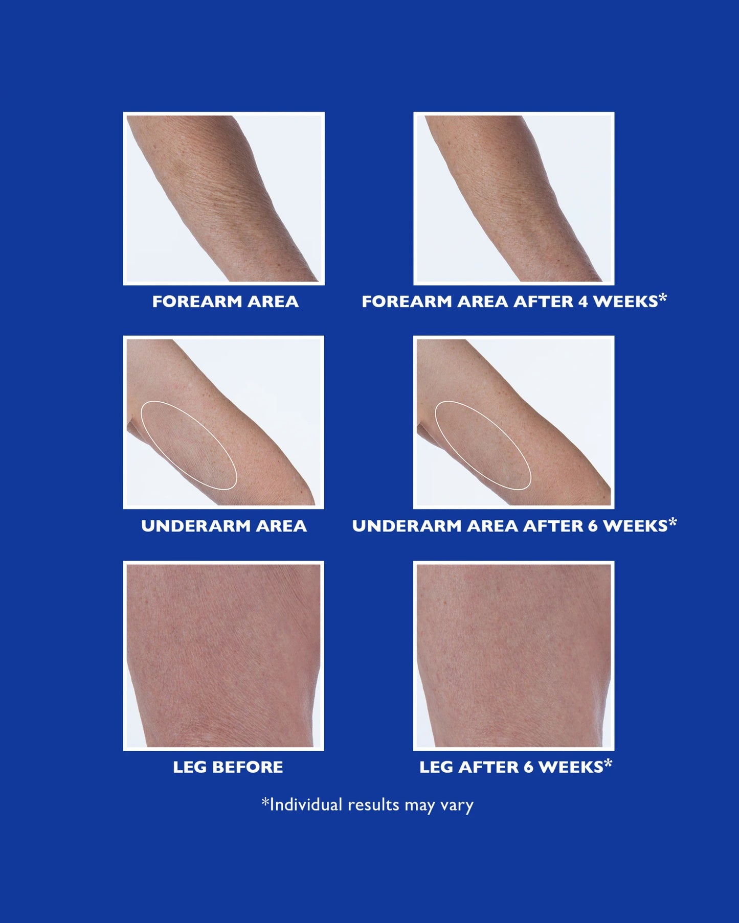 Retinol Fusion PM Night Serum
