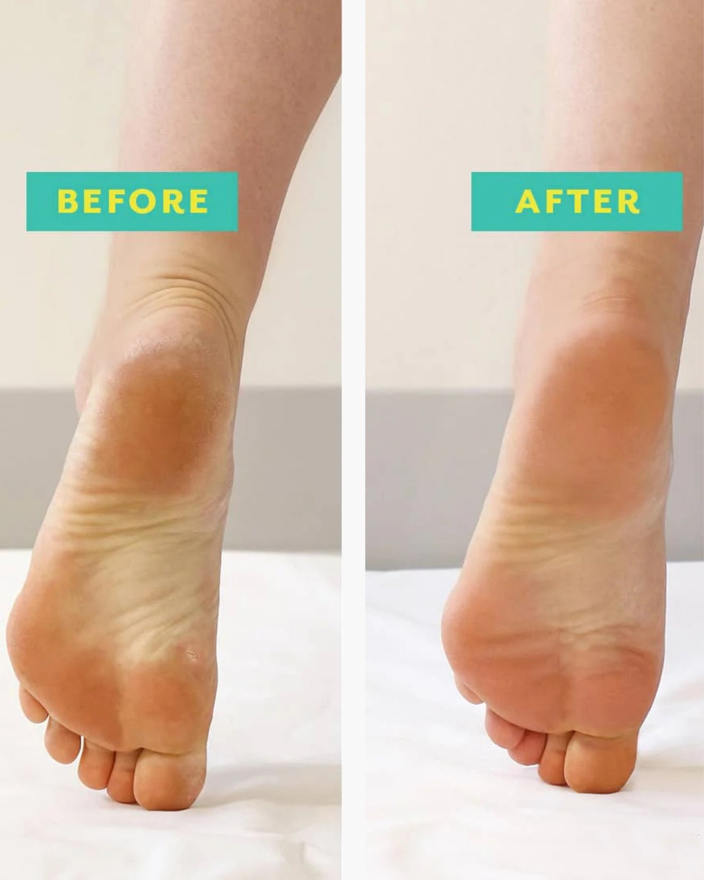 PoshPeel Pedi Cure