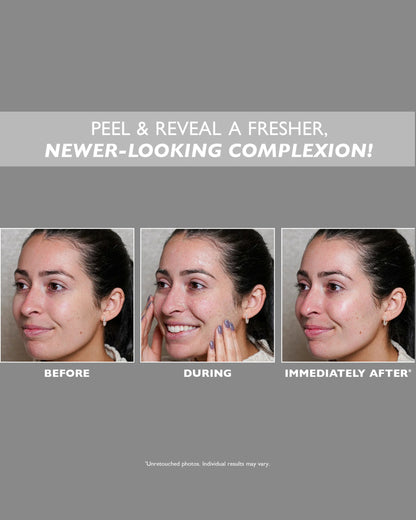 FIRMx Peeling Gel