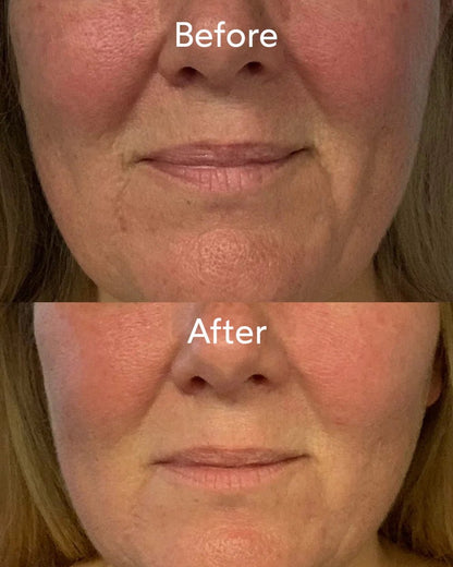 Renew Repair Nightly Treatment