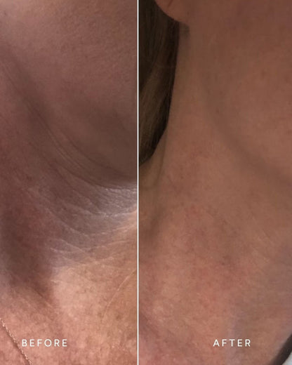 Renew Repair Nightly Treatment